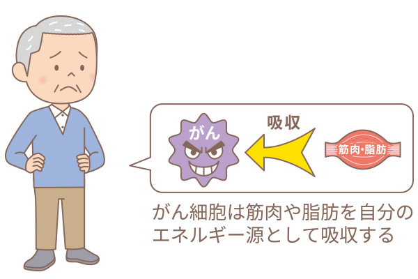 がん細胞は筋肉や脂肪を自分のエネルギー源として吸収する