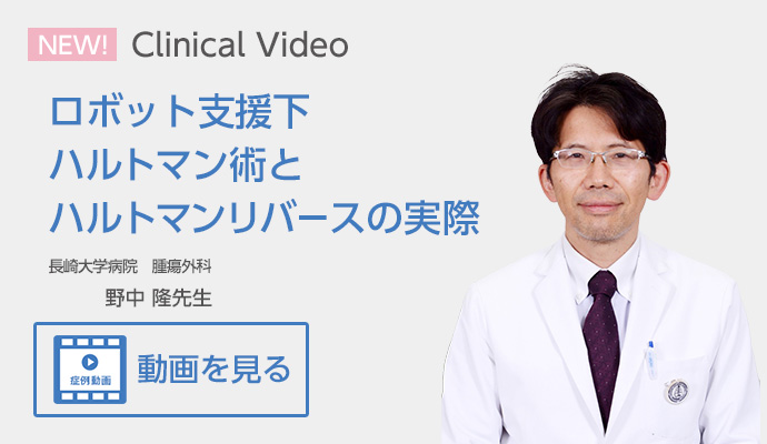 ロボット支援下ハルトマン術とハルトマンリバースの実際 長崎大学病院 腫瘍外科 野中 隆先生