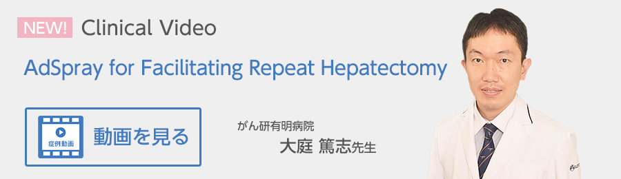 AdSpray for Facilitating Repeat Hepatectomy がん研有明病院 大庭 篤志先生