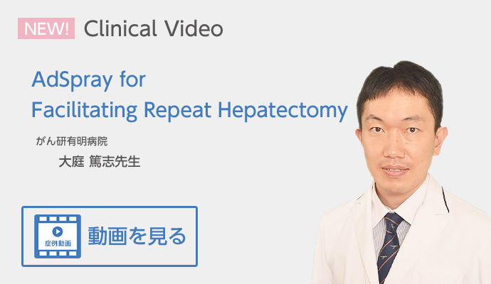 AdSpray for Facilitating Repeat Hepatectomy がん研有明病院 大庭 篤志先生