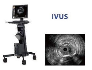 ivus