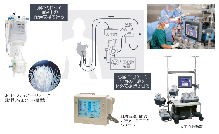 人工心肺システム