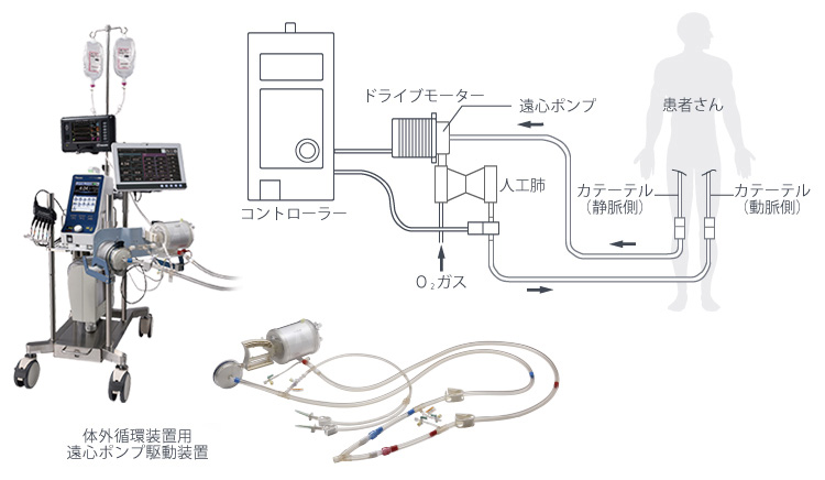 経皮的心肺補助システム（PCPS）／体外式膜型人工肺（ECMO）