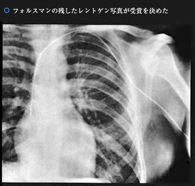 フォルスマンの残したレントゲン写真が受賞を決めた