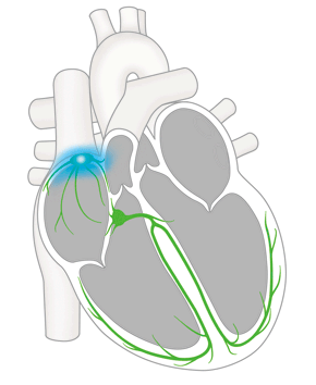 心臓の刺激伝導系