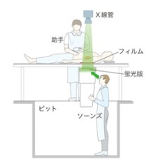 ソーンズが使ったX線撮影装置(概念図)
