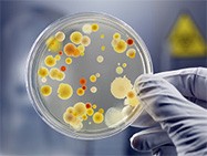 ペトリ皿で培養された細菌の集落