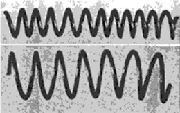 ドッターが開発した熱可変性のコイルスプリング加熱前（上）と加熱後（下）（Dotter C T et al. : Rdiology 147, 4, 1983）